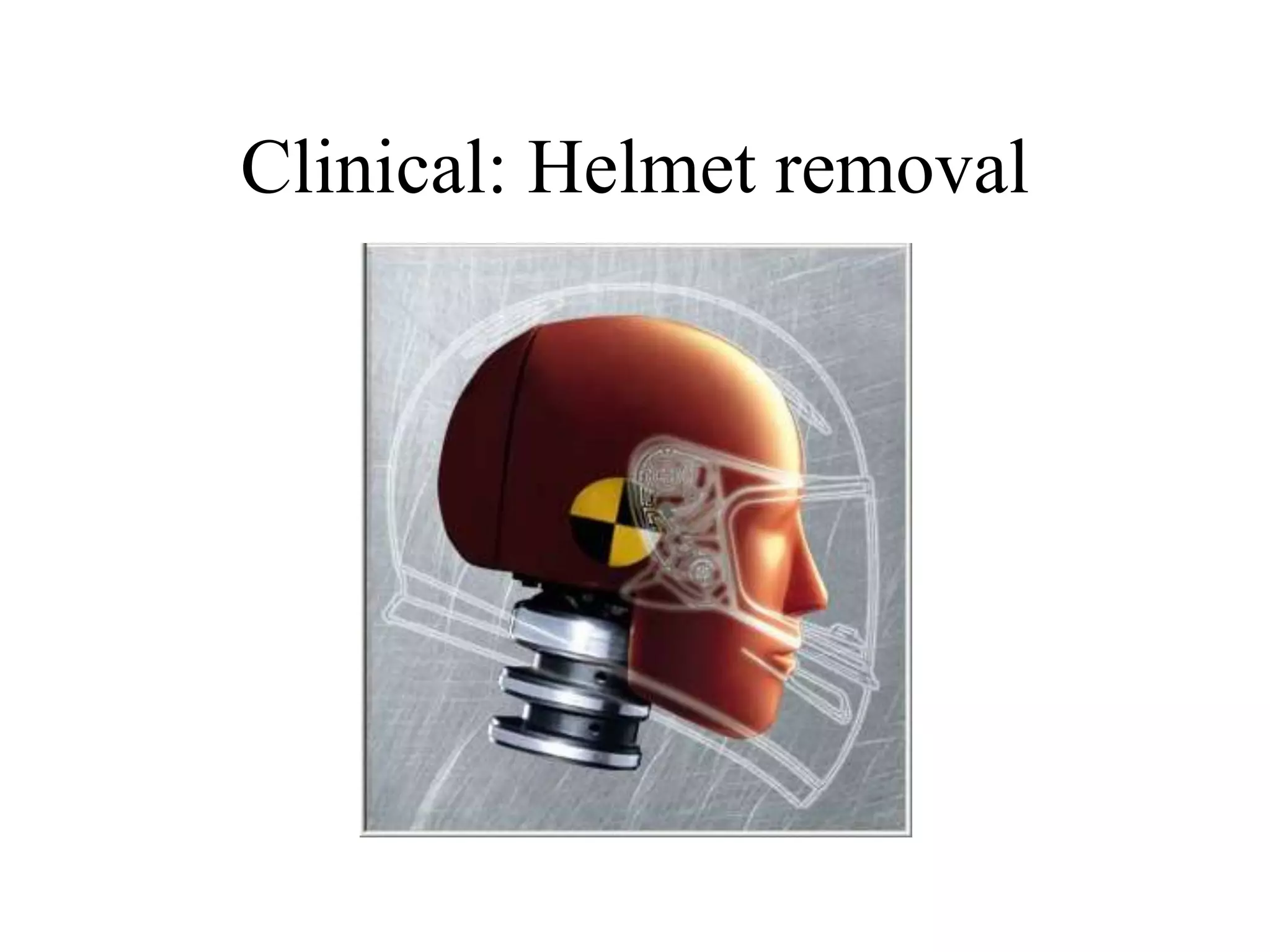 Clinical: Helmet removal
 