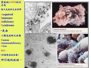 ̲(AIDS)ȫ 
 
ȱ֢Ⱥ 
Acquired 
Immuno-deficiency 
Syndrome 
? 
ȱ 
Human 
Immunodeficiency 
Virus 
HIV 
(׷Q̲) 
ļ 
 