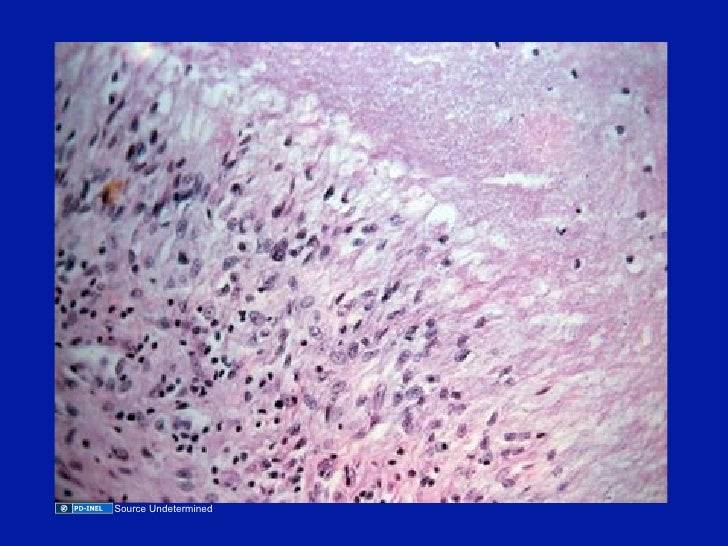 12.01.08(b): Immunosuppressive Therapies for Rheumatic 