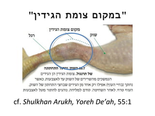 " במקום צומת הגידין " cf.  Shulkhan Arukh, Yoreh De ’ah , 55:1  