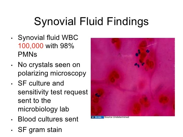 infected synovial fluid color