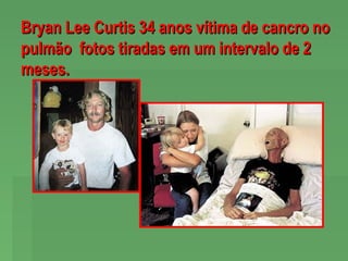 Bryan Lee Curtis 34 anos vítima de cancro no
pulmão fotos tiradas em um intervalo de 2
meses.

 