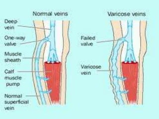 Normal Vesline 12027392.ppt
