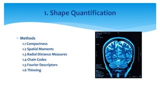  Methods
1.1 Compactness
1.2 Spatial Moments
1.3 Radial Distance Measures
1.4 Chain Codes
1.5 Fourier Descriptors
1.6 Thinning
1. Shape Quantification
 