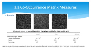  Results
2.2 Co-Occurrence Matrix Measures
Ultrasonic image of normal liver(left) , fatty liver(middle) and cirrhosis(right)
New: ‘Gray-Level Co-occurrence Matrix Bone Fracture Detection’ by HUM YAN CHAI, LAI KHIN WEE , TAN TIAN SWEE , SHEIKH HUSSAIN
 