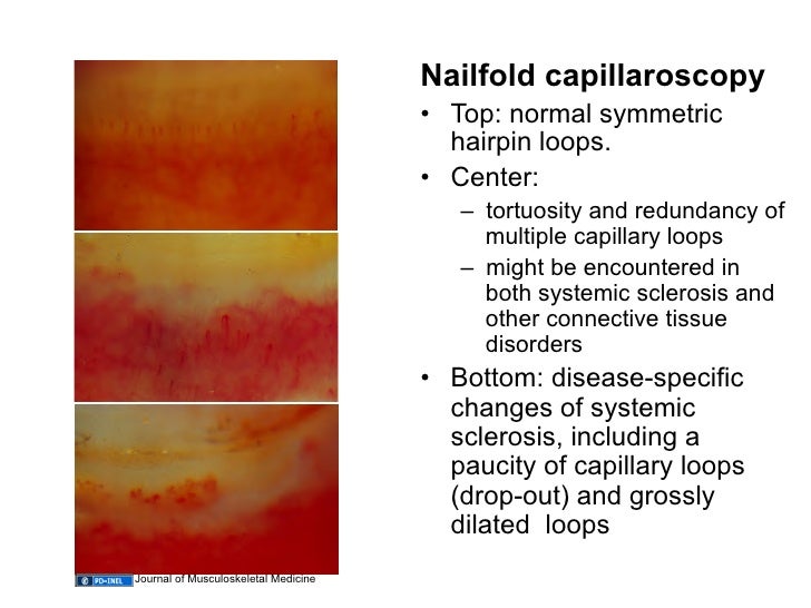 12.04.09 Autoantibodies and Rheumatologic Diseases When and How to