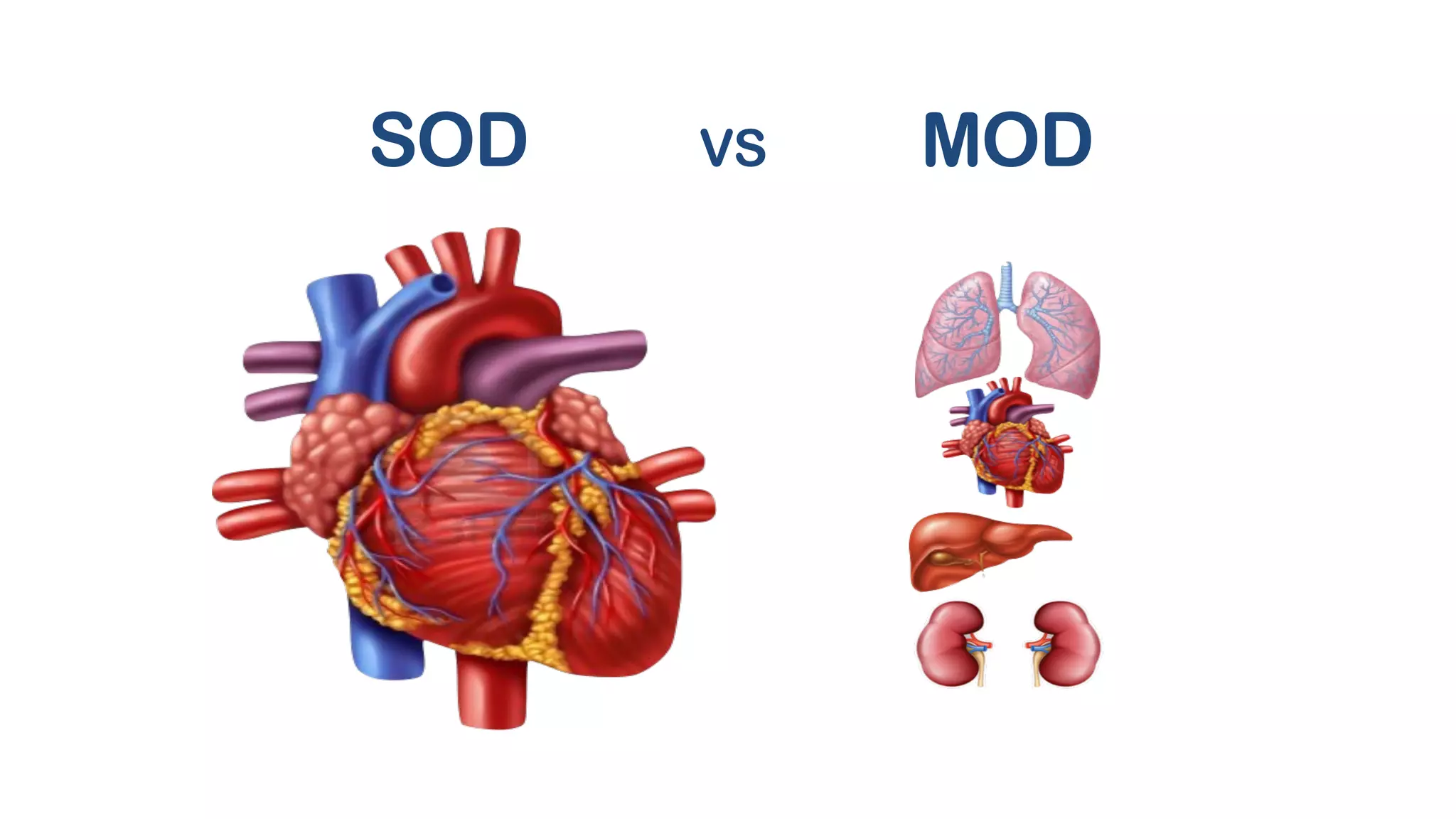 SOD VS MOD
 