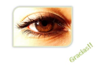 120604 diplopía pdf