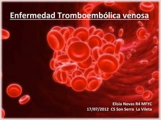 Enfermedad	
  Tromboembólica	
  venosa	
  




                                         Elisia	
  Novas	
  R4	
  MFYC	
  
                      17/07/2012	
  	
  CS	
  Son	
  Serra	
  	
  La	
  Vileta	
  	
  	
  
 