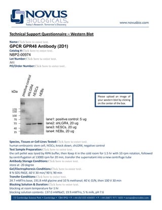 Technical Support Questionnaire – Western Blot
Name:Click here to enter text.
GPCR GPR48 Antibody (2D1)
Catalog #:Click here to enter text.
NBP2-00974
Lot Number:Click here to enter text.
A01
PO/Order Number:Click here to enter text..




                                                                     Please upload an image of
                                                                     your western blot by clicking
                                                                     on the center of the box.




Species, Tissues or Cell Lines Tested:Click here to enter text.
human embryonic stem cell, hESCs; knock down, shLGR4, negative control
Test Sample Preparation:Click here to enter text.
the cell pellet was lysed by RIPA buffer, then Keep it in the cold room for 1.5 hr with 10 rpm rotation, followed
by centrifugation at 13000 rpm for 20 min, transfer the supernatant into a new centrifuge tube
Antibody Storage Conditions:Click here to enter text.
store at -20 degree
Gel/Electrophoresis Conditions:Click here to enter text.
8 % SDS-PAGE, 60 V 30 min/ 90 V, 90 min
Transfer Conditions:Click here to enter text.
24.7 mMTris base, 191.8 mM glycine and 10 % methanol; 40 V, O/N, then 100 V 30 min
Blocking Solution & Duration:Click here to enter text.
blocking at room temperature for 1 hr
blocking solution contents: 137.0 mMNaCl, 19.9 mMTris, 5 % milk, pH 7.6
 