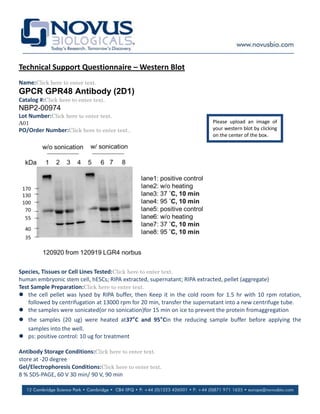 Technical Support Questionnaire – Western Blot
Name:Click here to enter text.
GPCR GPR48 Antibody (2D1)
Catalog #:Click here to enter text.
NBP2-00974
Lot Number:Click here to enter text.
A01                                                                       Please upload an image of
PO/Order Number:Click here to enter text..                                your western blot by clicking
                                                                          on the center of the box.




Species, Tissues or Cell Lines Tested:Click here to enter text.
human embryonic stem cell, hESCs; RIPA extracted, supernatant; RIPA extracted, pellet (aggregate)
Test Sample Preparation:Click here to enter text.
 the cell pellet was lysed by RIPA buffer, then Keep it in the cold room for 1.5 hr with 10 rpm rotation,
    followed by centrifugation at 13000 rpm for 20 min, transfer the supernatant into a new centrifuge tube.
 the samples were sonicated(or no sonication)for 15 min on ice to prevent the protein fromaggregation
 the samples (20 ug) were heated at37°C and 95°Cin the reducing sample buffer before applying the
  samples into the well.
 ps: positive control: 10 ug for treatment

Antibody Storage Conditions:Click here to enter text.
store at -20 degree
Gel/Electrophoresis Conditions:Click here to enter text.
8 % SDS-PAGE, 60 V 30 min/ 90 V, 90 min
 