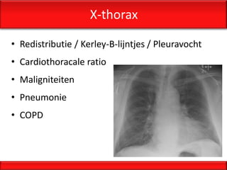 X-thorax

• Redistributie / Kerley-B-lijntjes / Pleuravocht
• Cardiothoracale ratio
• Maligniteiten
• Pneumonie
• COPD
 