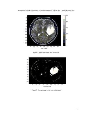 Computer Science & Engineering: An International Journal (CSEIJ), Vol.1, No.5, December 2011
7
Figure 2. Input noisy image with its colorbar.
Figure 3. Average image of the input noisy image
 