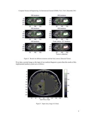 MRIIMAGE SEGMENTATION USING LEVEL SET METHOD AND IMPLEMENT AN MEDICAL ...