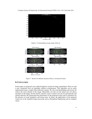 Computer Science & Engineering: An International Journal (CSEIJ), Vol.1, No.5, December 2011
9
Figure 6. Corresponding average image of Fig (4).
Figure 7. Results for different iterations (There is no detected Tumer)
8. CONCLUSION
In this paper we proposed a new medical diagnosis system for image segmentation. Here we used
a new variational level set algorithm without re-initialization. This algorithm can be easily
implemented using a simple finite difference scheme. We also used thresholding and erosion for
remove the noisy element of the image. Meanwhile, not only can the initial curve be shown
anywhere in the image, but the interior contours (such as tumers) can also be automatically and
quickly detected. We demonstrate the performance of the proposed system and its robustness for
the presence of weak boundaries and strong noise. In future, the applications of the proposed
system are in the manifold image processing such as Biomedical Engineering and in computer
vision.
 
