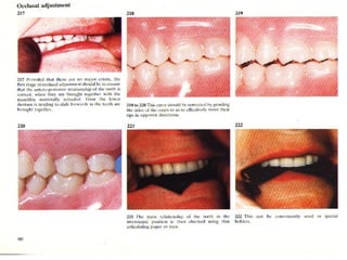 12 + المحاضرة 11 tooth selection