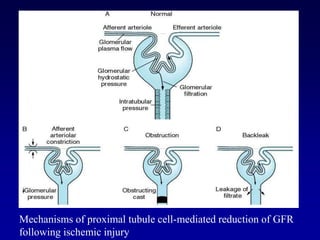 Mechanisms of proximal tubule cell-mediated reduction of GFR
following ischemic injury
 