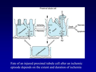 Fate of an injured proximal tubule cell after an ischemic
episode depends on the extent and duration of ischemia
 