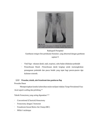 Radiografi Periapikal
Gambaran rontgen foto perlekatan frenulum yang abnormal dengan gambaran
septum V
· Vital Sign : tekanan darah, nadi, respirasi, suhu badan dilakukan prabedah
· Pemeriksaan Darah : Pemeriksaan darah lengkap untuk memungkinkan
penanganan prabedah dan pasca bedah yang tepat bagi pasien-pasien dgn
kelainan sistemik.
2.3.5 Prosedur, teknik, alat frenektomi dan gambaran flap
Prosedur Dasar
Mempersiapkan kondisi kebersihan mulut meliputi tidakan Terapi Periodontal Fase
Awal seperti scalling dan polishing.10
Teknik Frenectomy yang sering digunakan:6,10
· Conventional (Classical) frenectomy
· Frenectomy dengan 2 hemostat
· Frenektomi Insisal Below the Clamp (IBC)
· Miller’s technique
 