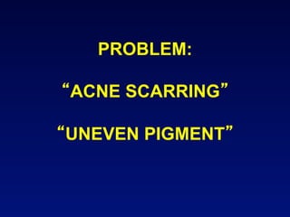 PROBLEM:

ACNE SCARRING

UNEVEN PIGMENT
 