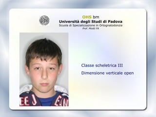 OHS  bm Università degli Studi di Padova Scuola di Specializzazione in Ortognatodonzia Prof. Miotti FA ,[object Object],[object Object]