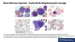 regulation of hematopoesis and leukemia1 | PDF