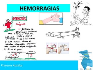Primeros Auxilios
HEMORRAGIAS
 