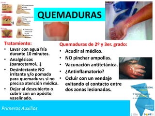 Primeros Auxilios
QUEMADURAS
Tratamiento:
• Lavar con agua fría
durante 10 minutos.
• Analgésicos
(paracetamol...).
• Desinfectante NO
irritante y/o pomada
para quemaduras si no
precisa atención médica.
• Dejar al descubierto o
cubrir con un apósito
vaselinado.
Quemaduras de 2º y 3er. grado:
• Acudir al médico.
• NO pinchar ampollas.
• Vacunación antitetánica.
• ¿Antinflamatorio?
• Ocluir con un vendaje
evitando el contacto entre
dos zonas lesionadas.
 