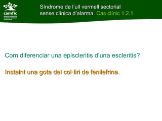Síndrome de l’ull vermell sectorial
              sense clínica d’alarma Cas clínic 1.2.1




Com diferenciar una episcleritis d’una escleritis?

Instalnt una gota del col·liri de fenilefrina.
 