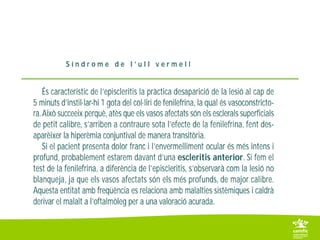 1 2 1 episcleritis