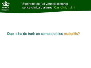 Síndrome de l’ull vermell sectorial
         sense clínica d’alarma Cas clínic 1.2.1




Que s’ha de tenir en compte en les escleritis?
 