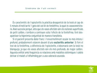 1 2 1 episcleritis