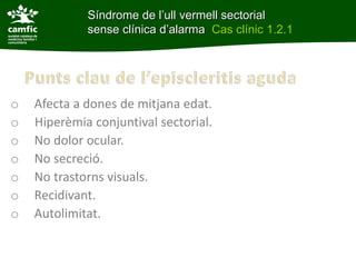 Síndrome de l’ull vermell sectorial
             sense clínica d’alarma Cas clínic 1.2.1




o   Afecta a dones de mitjana edat.
o   Hiperèmia conjuntival sectorial.
o   No dolor ocular.
o   No secreció.
o   No trastorns visuals.
o   Recidivant.
o   Autolimitat.
 
