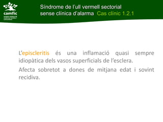 Síndrome de l’ull vermell sectorial
       sense clínica d’alarma Cas clínic 1.2.1




L’episcleritis és una inflamació quasi sempre
idiopàtica dels vasos superficials de l’esclera.
Afecta sobretot a dones de mitjana edat i sovint
recidiva.
 