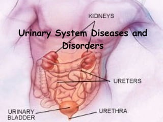 Urinary System Diseases and Disorders 