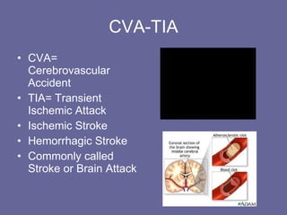 CVA-TIA CVA= Cerebrovascular Accident TIA= Transient Ischemic Attack Ischemic Stroke Hemorrhagic Stroke Commonly called Stroke or Brain Attack 