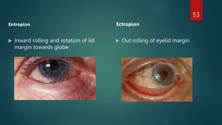 Inward Rotation Of Eye anatomy of eyelid ophthalmology presentation | PPTX