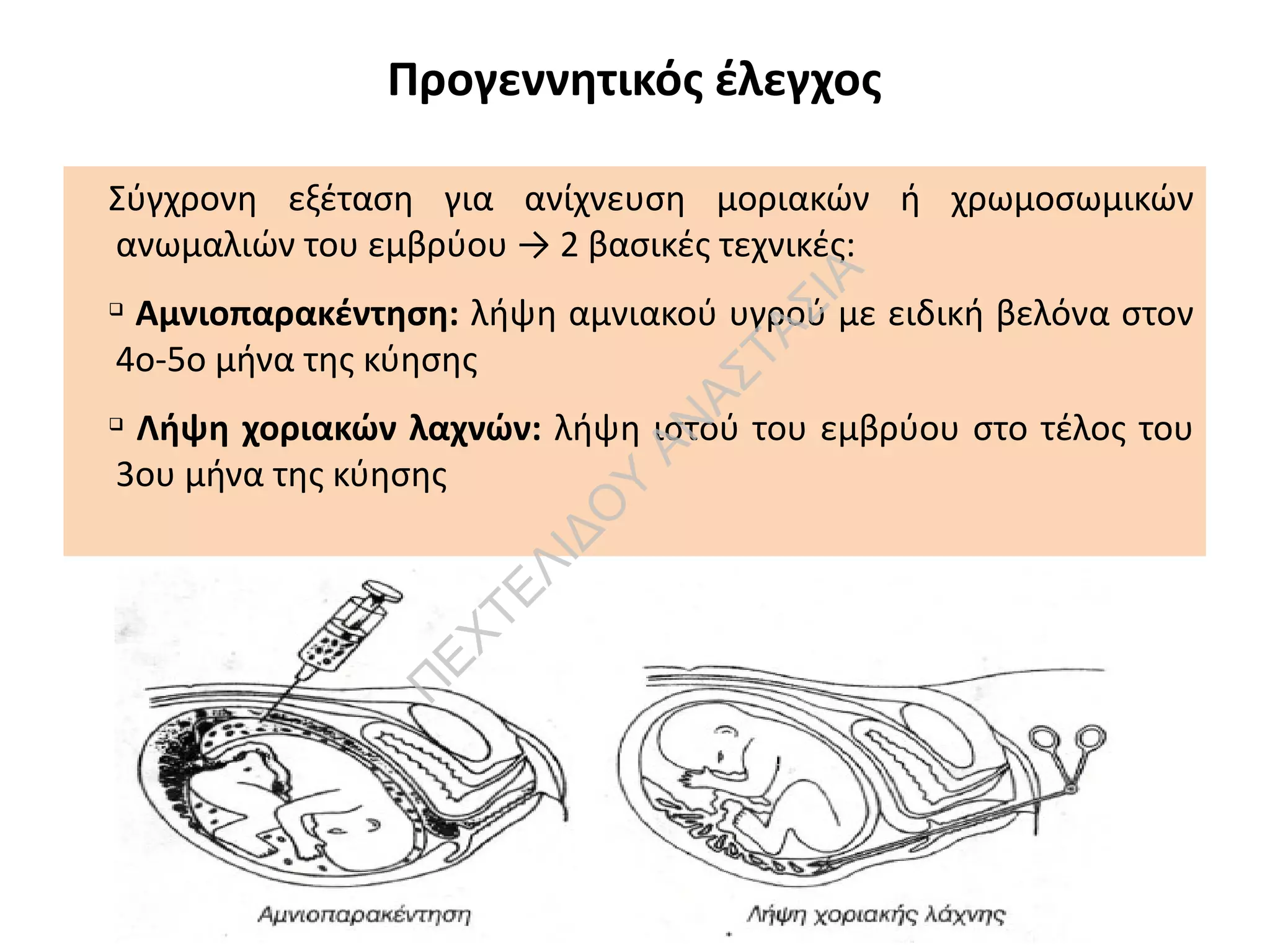 Προγεννητικός έλεγχος
Σύγχρονη εξέταση για ανίχνευση μοριακών ή χρωμοσωμικών
ανωμαλιών του εμβρύου → 2 βασικές τεχνικές:
q
Αμνιοπαρακέντηση: λήψη αμνιακού υγρού με ειδική βελόνα στον
4ο-5ο μήνα της κύησης
q
Λήψη χοριακών λαχνών: λήψη ιστού του εμβρύου στο τέλος του
3ου μήνα της κύησης
Π
ΕΧΤΕΛΙΔΟ
Υ
ΑΝ
ΑΣΤΑΣΙΑ
 