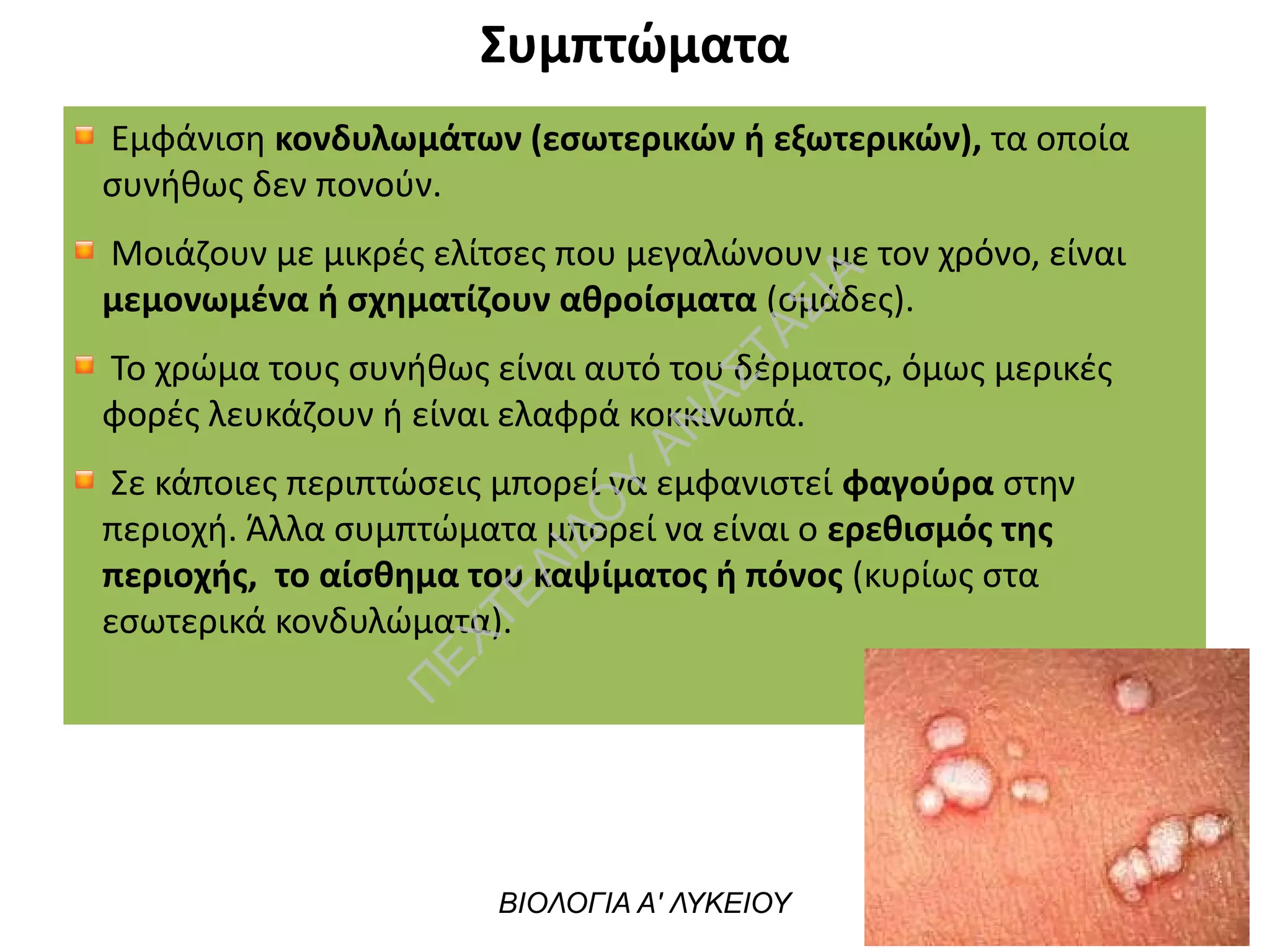Συμπτώματα
Εμφάνιση κονδυλωμάτων (εσωτερικών ή εξωτερικών), τα οποία
συνήθως δεν πονούν. 
Μοιάζουν με μικρές ελίτσες που μεγαλώνουν με τον χρόνο, είναι
μεμονωμένα ή σχηματίζουν αθροίσματα (ομάδες).
Το χρώμα τους συνήθως είναι αυτό του δέρματος, όμως μερικές
φορές λευκάζουν ή είναι ελαφρά κοκκινωπά.
Σε κάποιες περιπτώσεις μπορεί να εμφανιστεί φαγούρα στην
περιοχή. Άλλα συμπτώματα μπορεί να είναι ο ερεθισμός της
περιοχής,  το αίσθημα του καψίματος ή πόνος (κυρίως στα
εσωτερικά κονδυλώματα).
ΒΙΟΛΟΓΙΑ Α' ΛΥΚΕΙΟΥ
Π
ΕΧΤΕΛΙΔΟ
Υ
ΑΝ
ΑΣΤΑΣΙΑ
 