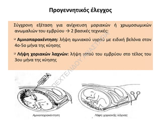 Προγεννητικός έλεγχος
Σύγχρονη εξέταση για ανίχνευση μοριακών ή χρωμοσωμικών
ανωμαλιών του εμβρύου → 2 βασικές τεχνικές:
q
Αμνιοπαρακέντηση: λήψη αμνιακού υγρού με ειδική βελόνα στον
4ο-5ο μήνα της κύησης
q
Λήψη χοριακών λαχνών: λήψη ιστού του εμβρύου στο τέλος του
3ου μήνα της κύησης
Π
ΕΧΤΕΛΙΔΟ
Υ
ΑΝ
ΑΣΤΑΣΙΑ
 