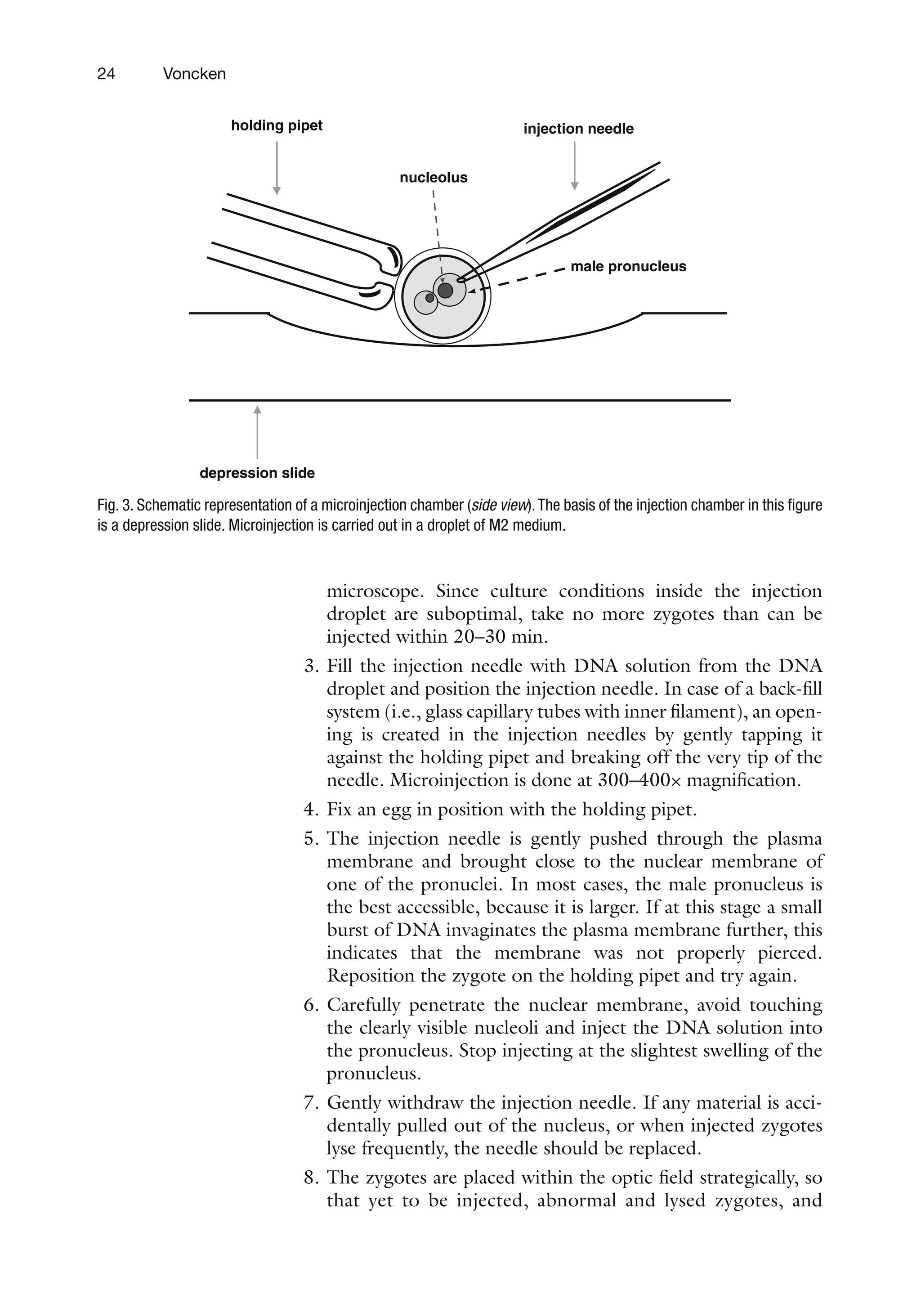 24 Voncken
microscope. Since culture conditions inside the injection
droplet are suboptimal, take no more zygotes than can be
injected within 20–30 min.
3. Fill the injection needle with DNA solution from the DNA
droplet and position the injection needle. In case of a back-fill
system (i.e., glass capillary tubes with inner filament), an open-
ing is created in the injection needles by gently tapping it
against the holding pipet and breaking off the very tip of the
needle. Microinjection is done at 300–400× magnification.
4. Fix an egg in position with the holding pipet.
5. The injection needle is gently pushed through the plasma
membrane and brought close to the nuclear membrane of
one of the pronuclei. In most cases, the male pronucleus is
the best accessible, because it is larger. If at this stage a small
burst of DNA invaginates the plasma membrane further, this
indicates that the membrane was not properly pierced.
Reposition the zygote on the holding pipet and try again.
6. Carefully penetrate the nuclear membrane, avoid touching
the clearly visible nucleoli and inject the DNA solution into
the pronucleus. Stop injecting at the slightest swelling of the
pronucleus.
7. Gently withdraw the injection needle. If any material is acci-
dentally pulled out of the nucleus, or when injected zygotes
lyse frequently, the needle should be replaced.
8. The zygotes are placed within the optic field strategically, so
that yet to be injected, abnormal and lysed zygotes, and
holding pipet injection needle
depression slide
male pronucleus
nucleolus
Fig. 3. Schematic representation of a microinjection chamber (side view).The basis of the injection chamber in this figure
is a depression slide. Microinjection is carried out in a droplet of M2 medium.
 