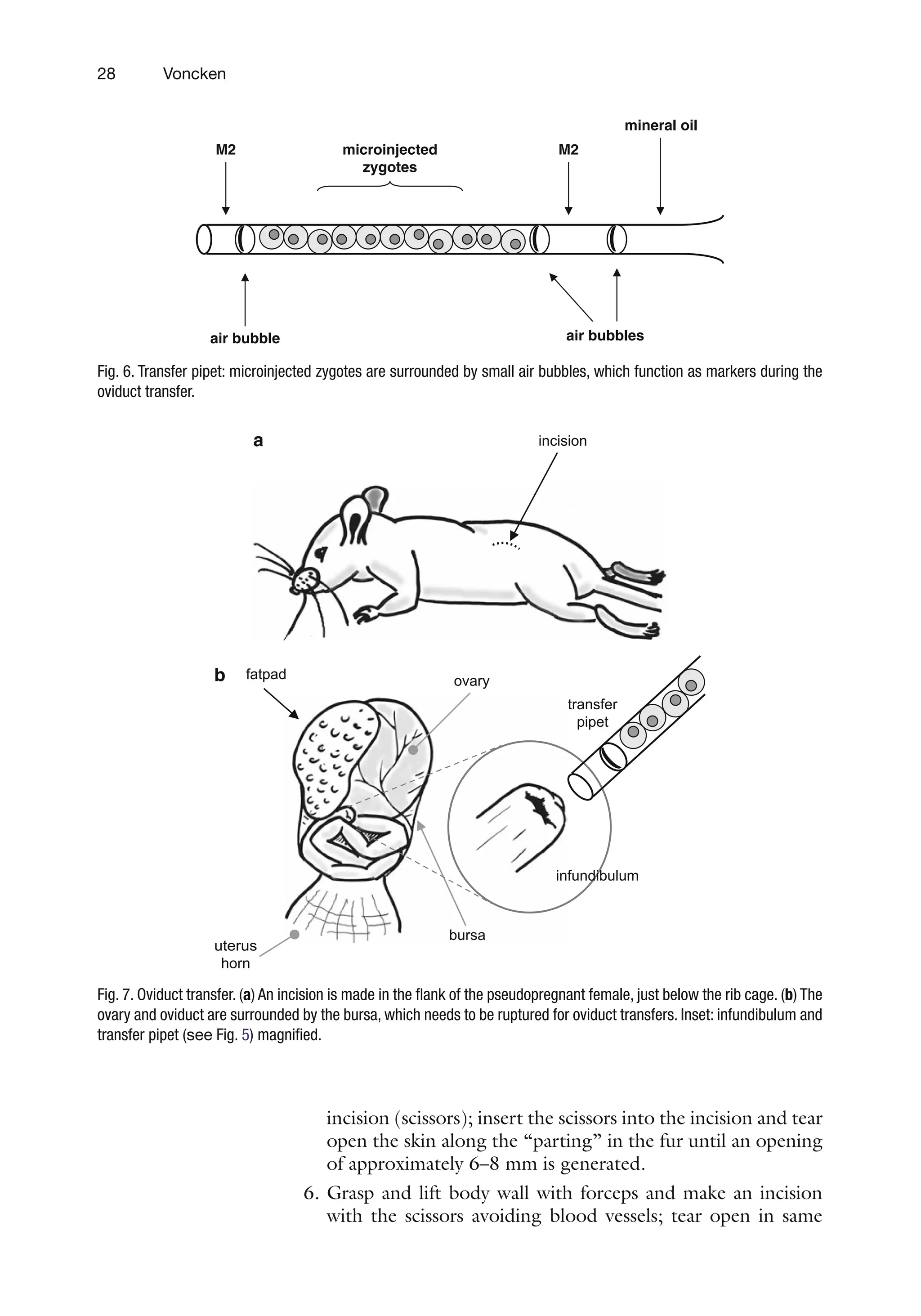 28 Voncken
incision (scissors); insert the scissors into the incision and tear
open the skin along the “parting” in the fur until an opening
of approximately 6–8 mm is generated.
6. Grasp and lift body wall with forceps and make an incision
with the scissors avoiding blood vessels; tear open in same
M2
M2
mineral oil
air bubble air bubbles
microinjected
zygotes
Fig. 6. Transfer pipet: microinjected zygotes are surrounded by small air bubbles, which function as markers during the
oviduct transfer.
fatpad
uterus
horn
ovary
transfer
pipet
b
infundibulum
bursa
a incision
Fig. 7. Oviduct transfer. (a) An incision is made in the flank of the pseudopregnant female, just below the rib cage. (b) The
ovary and oviduct are surrounded by the bursa, which needs to be ruptured for oviduct transfers. Inset: infundibulum and
transfer pipet (see Fig. 5) magnified.
 