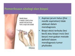 Pemeriksaan sitologi dan biopsi
• Aspirasi jarum halus (fine
needle aspiration) tidak
adekuat dalam
mendiagnosis
• Biopsi eksisi terbuka (lesi
kecil) atau biopsi insisi (lesi
besar) merupakan metode
definitif dalam
mendiagnosis tumor
phylloides
 
