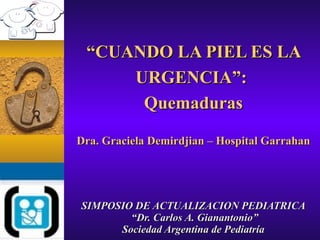 “ CUANDO LA PIEL ES LA URGENCIA”:  Quemaduras Dra. Graciela Demirdjian – Hospital Garrahan SIMPOSIO DE ACTUALIZACION PEDIATRICA  “Dr. Carlos A. Gianantonio” Sociedad Argentina de Pediatría 