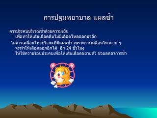 การปฐมพยาบาล แผลช้ำ ควรประคบบริเวณช้ำด้วยความเย็น เพื่อทำให้เส้นเลือดตีบไม่มีเลือดไหลออกมาอีก ไม่ควรเคลื่อนไหวบริเวณที่มีแผลช้ำ เพราะการเคลื่อนไหวมาก ๆ จะทำให้เลือดออกอีกได้    อีก  24  ชั่วโมง ให้ใช้ความร้อนประคบเพื่อให้เส้นเลือดขยายตัว ช่วยลดอาการช้ำ  