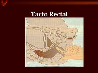 Tacto Rectal
 