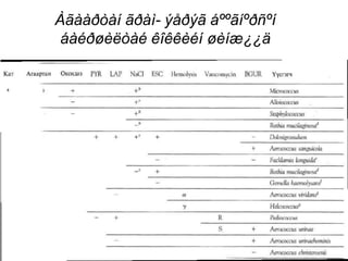 Àãààðòàí ãðàì- ýåðýã áººãíºðñºí
áàéðøèëòàé êîêêèéí øèíæ¿¿ä
 