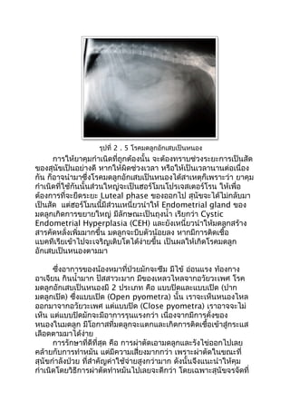 การให้ยาคุมกำาเนิดที่ถูกต้องนั้น จะต้องทราบช่วงระยะการเป็นสัด
ของสุนัขเป็นอย่างดี หากให้ผิดช่วงเวลา หรือให้เป็นเวลานานต่อเนื่อง
กัน ก็อาจนำามาซึ่งโรคมดลูกอักเสบเป็นหนองได้สาเหตุก็เพราะว่า ยาคุม
กำาเนิดที่ใช้กันนั้นส่วนใหญ่จะเป็นฮอร์โมนโปรเจสเตอร์โรน ให้เพื่อ
ต้องการที่จะยืดระยะ Luteal phase ของออกไป สุนัขจะได้ไม่กลับมา
เป็นสัด แต่ฮอร์โมนนี้มีส่วนเหนี่ยวนำาให้ Endometrial gland ของ
มดลูกเกิดการขยายใหญ่ มีลักษณะเป็นถุงนำ้า เรียกว่า Cystic
Endometrial Hyperplasia (CEH) และยังเหนี่ยวนำาให้มดลูกสร้าง
สารคัดหลั่งเพิ่มมากขึ้น มดลูกจะบีบตัวน้อยลง หากมีการติดเชื้อ
แบคทีเรียเข้าไปจะเจริญเติบโตได้ง่ายขึ้น เป็นผลให้เกิดโรคมดลูก
อักเสบเป็นหนองตามมา
ซึ่งอาการของน้องหมาที่ป่วยมักจะซึม มีไข้ อ่อนแรง ท้องกาง
อาเจียน กินนำ้ามาก ปัสสาวะมาก มีของเหลวไหลจากอวัยวะเพศ โรค
มดลูกอักเสบเป็นหนองมี 2 ประเภท คือ แบบปิดและแบบเปิด (ปาก
มดลูกเปิด) ซึ่งแบบเปิด (Open pyometra) นั้น เราจะเห็นหนองไหล
ออกมาจากอวัยวะเพศ แต่แบบปิด (Close pyometra) เราอาจจะไม่
เห็น แต่แบบปิดมักจะมีอาการรุนแรงกว่า เนื่องจากมีการคั่งของ
หนองในมดลูก มีโอกาสที่มดลูกจะแตกและเกิดการติดเชื้อเข้าสู่กระแส
เลือดตามมาได้ง่าย
การรักษาที่ดีที่สุด คือ การผ่าตัดเอามดลูกและรังไข่ออกไปเลย
คล้ายกับการทำาหมัน แต่มีความเสี่ยงมากกว่า เพราะผ่าตัดในขณะที่
สุนัขกำาลังป่วย ที่สำาคัญค่าใช้จ่ายสูงกว่ามาก ดังนั้นจึงแนะนำาให้คุม
กำาเนิดโดยวิธีการผ่าตัดทำาหมันไปเลยจะดีกว่า โดยเฉพาะสุนัขจรจัดที่
รุปที่ 2 . 5 โรคมดลูกอักเสบเป็นหนอง
 