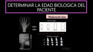 DETERMINAR LA EDAD BIOLOGICA DEL
PACIENTE
 