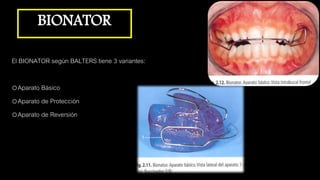 BIONATOR
El BIONATOR según BALTERS tiene 3 variantes:
oAparato Básico
oAparato de Protección
oAparato de Reversión
 